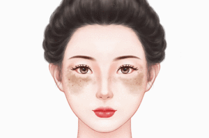 去晒斑