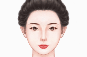 玻尿酸丰卧蚕