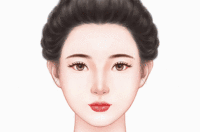 玻尿酸丰眉弓