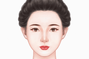 眉弓玻尿酸充填术