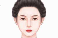 玻尿酸丰眼窝
