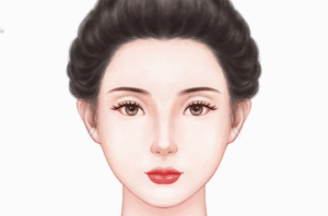 玻尿酸丰眼窝