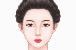 自体脂肪丰卧蚕