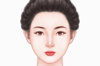 隆眉弓失败修复