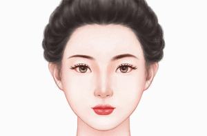 隆眉弓失败修复