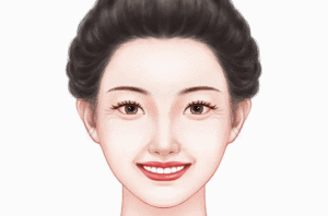 小切口除皱去鱼尾纹