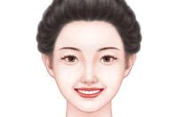 玻尿酸去鱼尾纹