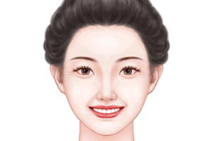 玻尿酸去鱼尾纹