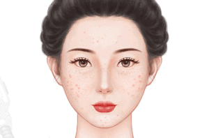 E光嫩肤