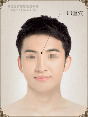 印堂穴