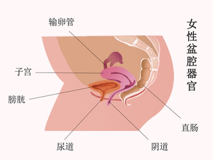 盆腔炎
