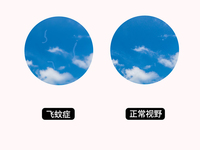飞蚊症