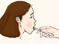 咽部异感症