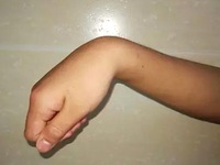 垂腕