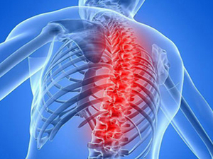 节段性分离性感觉障碍