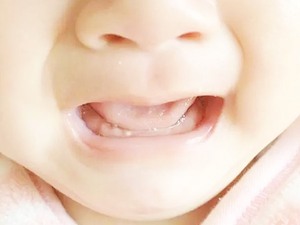吮乳困难
