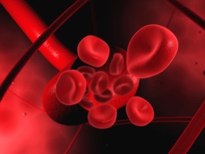 血流动力学障碍