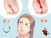月经稀少