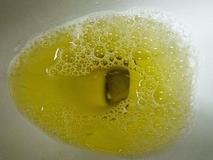 尿液异味