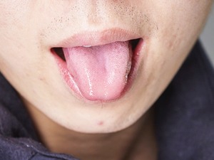舌震颤