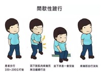 间歇性跛行