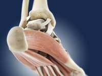 肌腱粘连