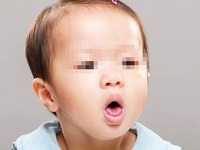 鸡鸣样回声