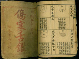 伤寒舌鉴