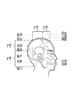 后顶穴