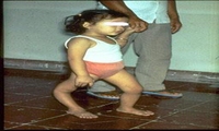 软脚瘟