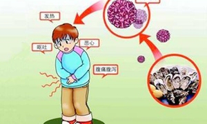 病毒性腹泻