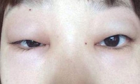 阳水