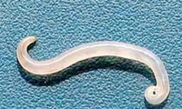 蛲虫病