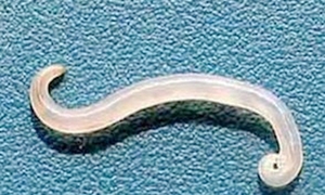 蛲虫病