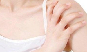 先天性高肩胛症