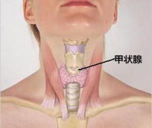 瘿痈
