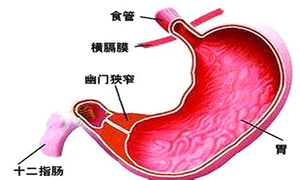 嘈杂