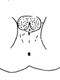囊底穴