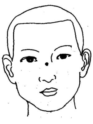 鼻交頞中穴
