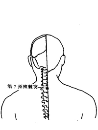 顶椎穴