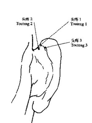 头疼三穴