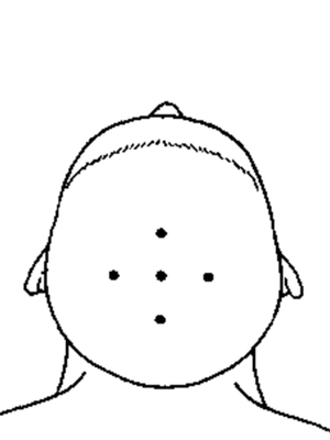 四神针