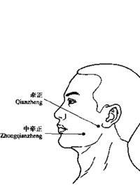 牵正二穴