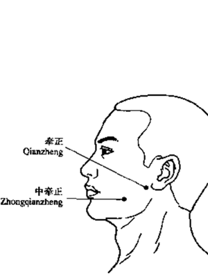 牵正二穴