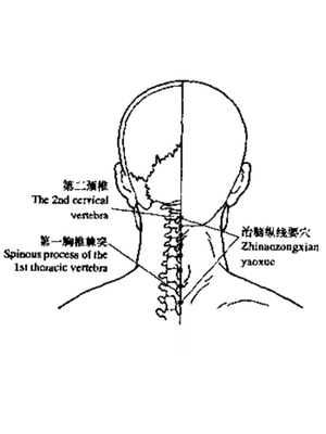 治脑纵线要穴