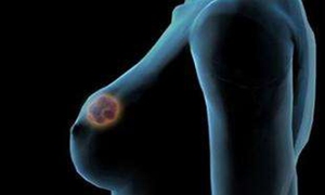 经行乳房胀痛