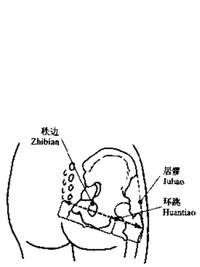 髋三针