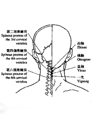 治脑四穴