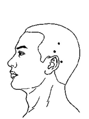 颞三