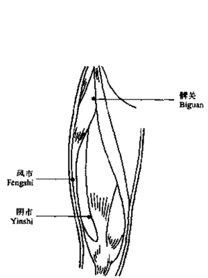 股三针
